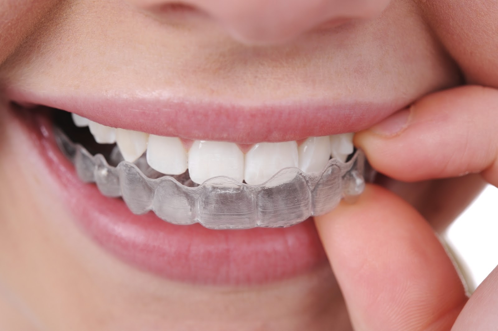 Stay Safe and Healthy with Clear Aligners During COVID-19