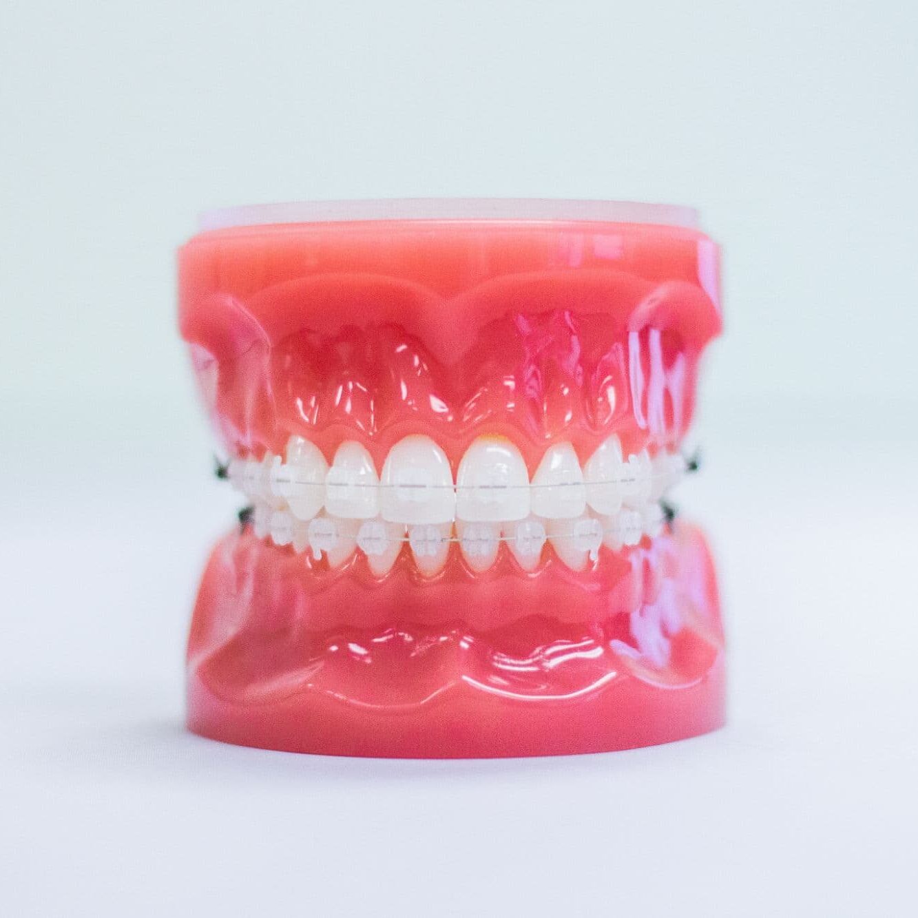 Clear Braces Oxnard CA